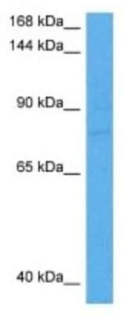Collagen IV alpha5 Rabbit anti-Human, Polyclonal, Novus Biologicals:Antibodies:Primary
